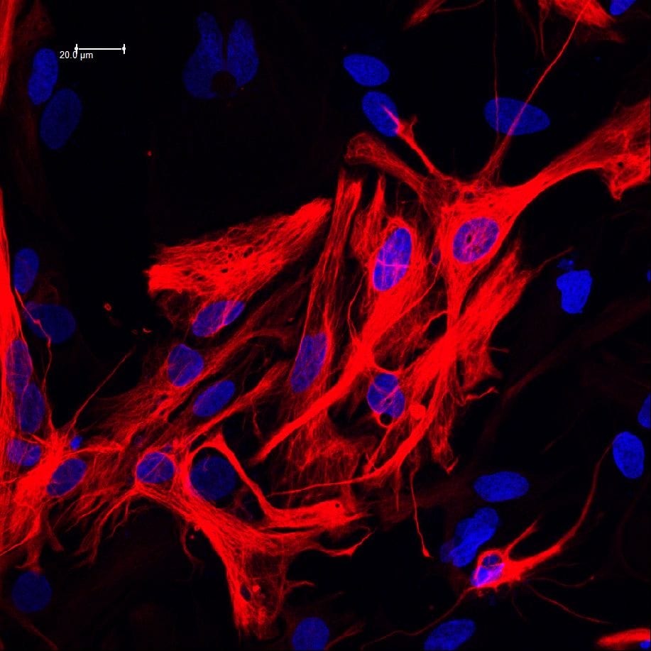 Axol-Bioscience-human-iPSC-image-ir_attachment_46297.jpeg