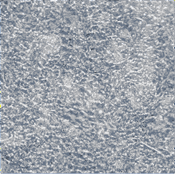 Axol-Bioscience-human-iPSC-image-ir_attachment_6060.gif