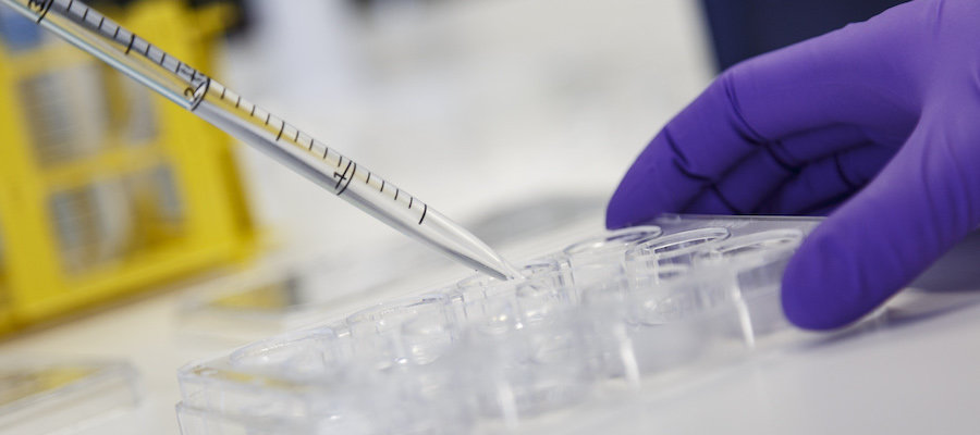 Axol-Bioscience-human-iPSC-image-blog_post_111.jpeg