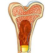 Axol-Bioscience-human-iPSC-image-ir_attachment_14828.jpg