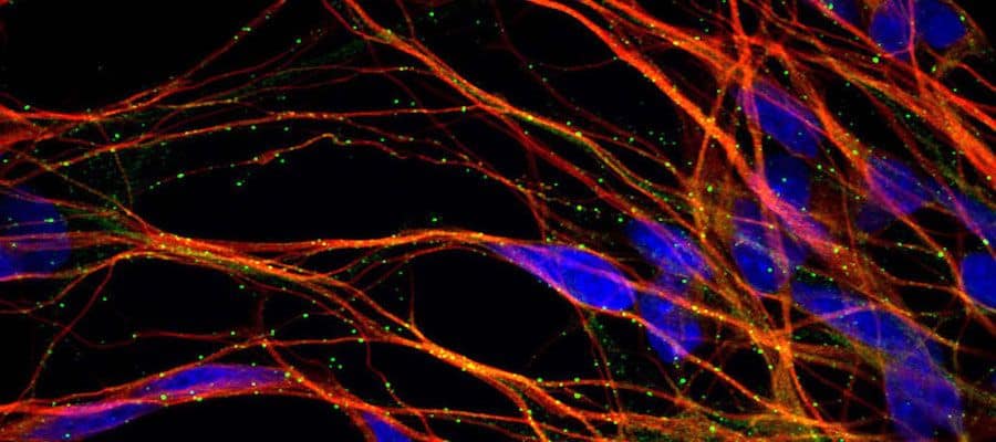 Axol-Bioscience-human-iPSC-image-ir_attachment_78530.jpeg